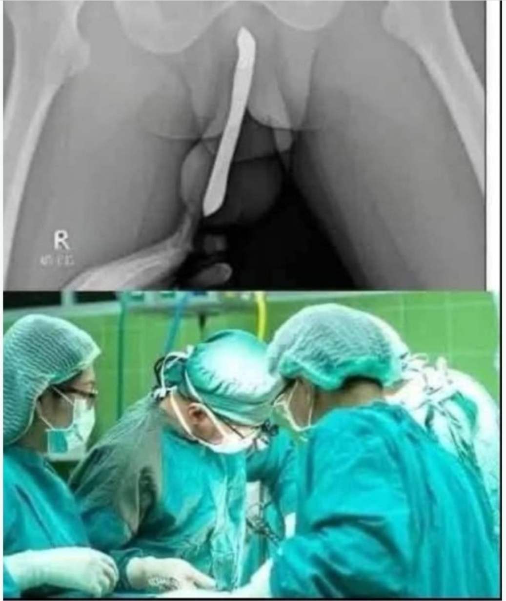 Doctors are speechless: Just boil these 2 ingredients and you will quickly lose your body fat !!